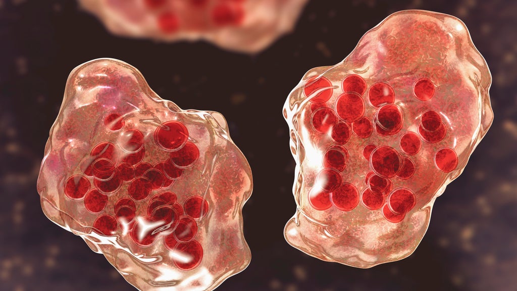 Central Minnesota county reports "several cases of suspected measles" — WCCO / CBS Minnesota, Roseville Health news