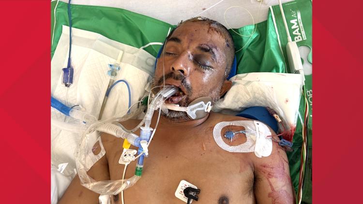 University Hospital asks for help identifying unconscious patient hit by truck Saturday evening — KENS 5 (San Antonio), Roseville Health news